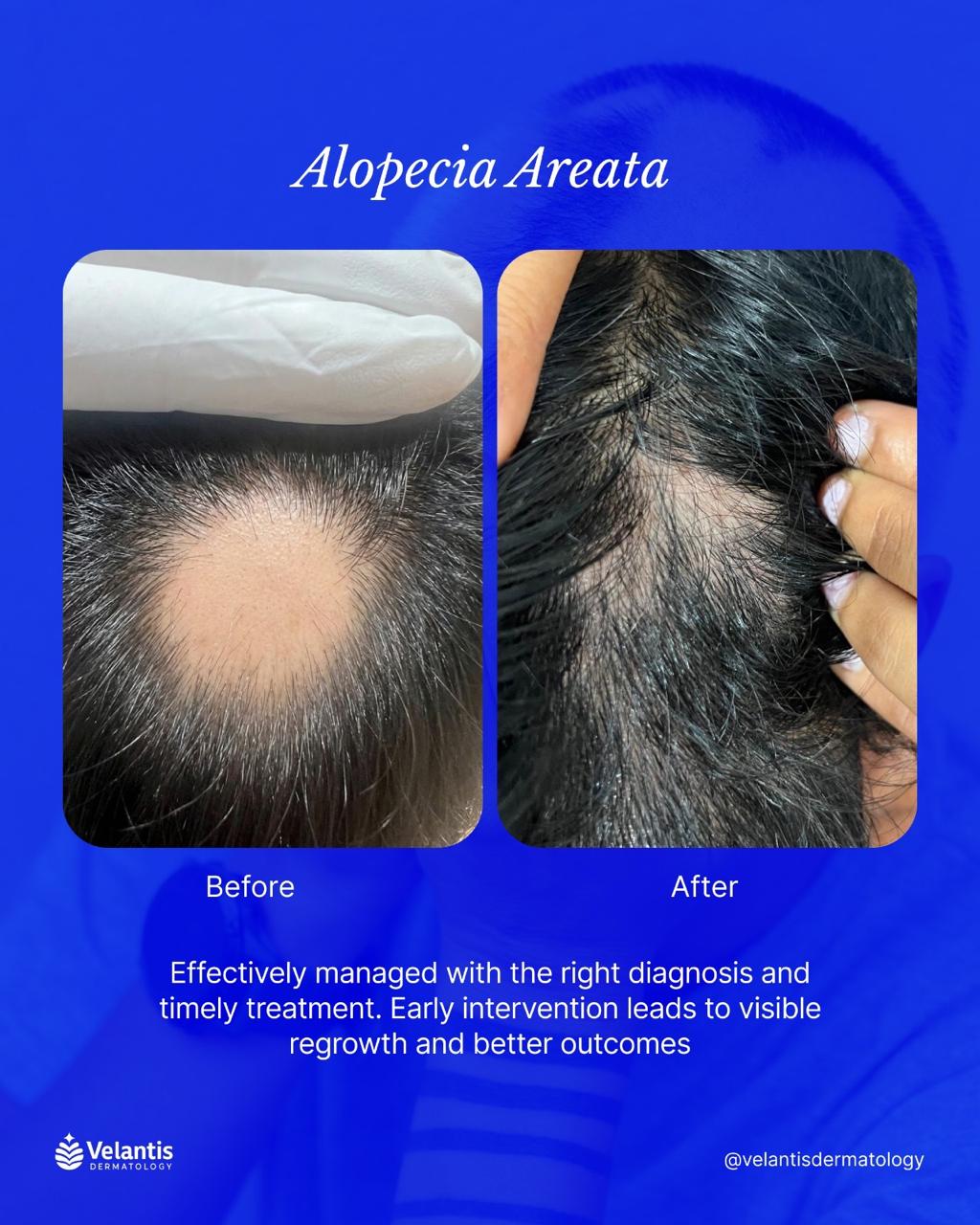 Velantis Dermatology Gallery